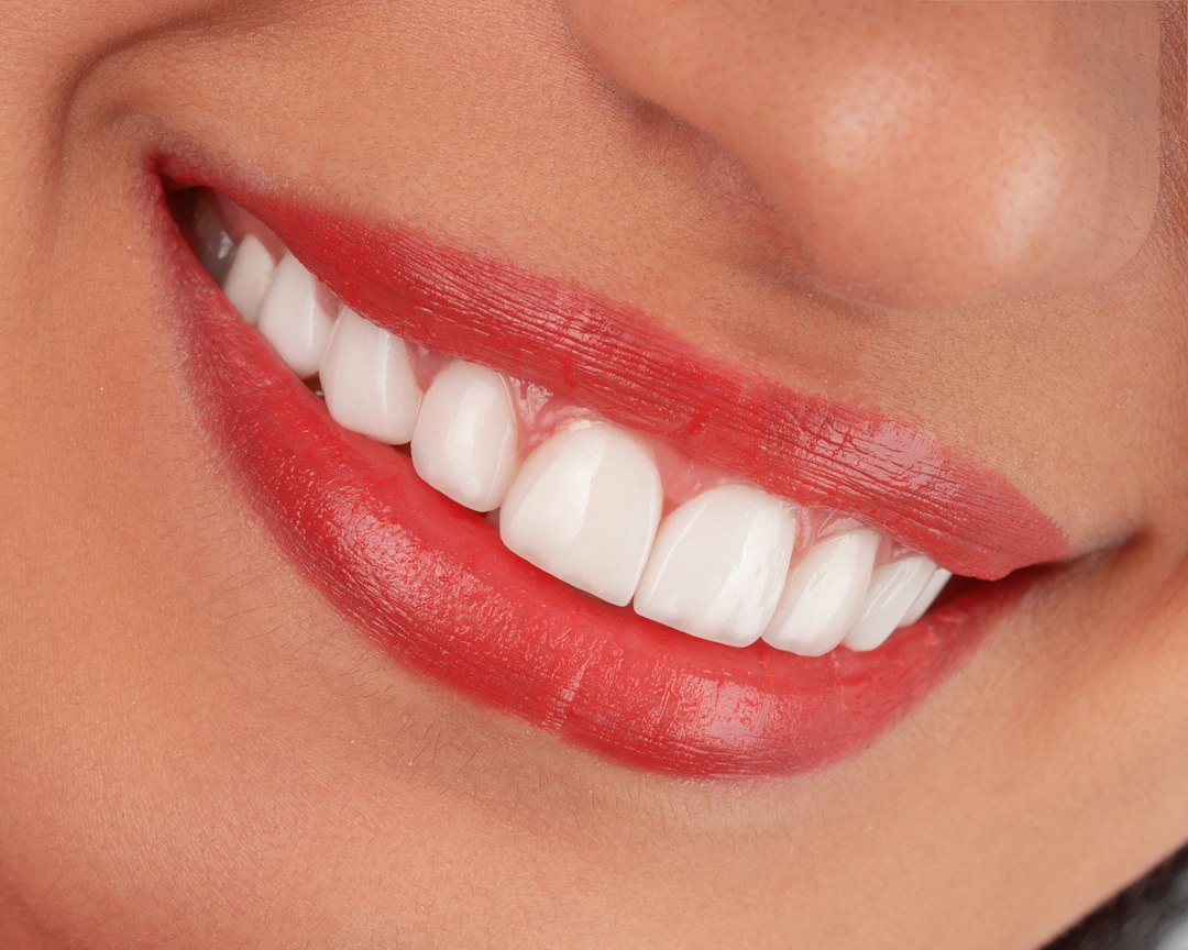 Tannbleking Hjemme: En Komplett Guide til Lysere Smil